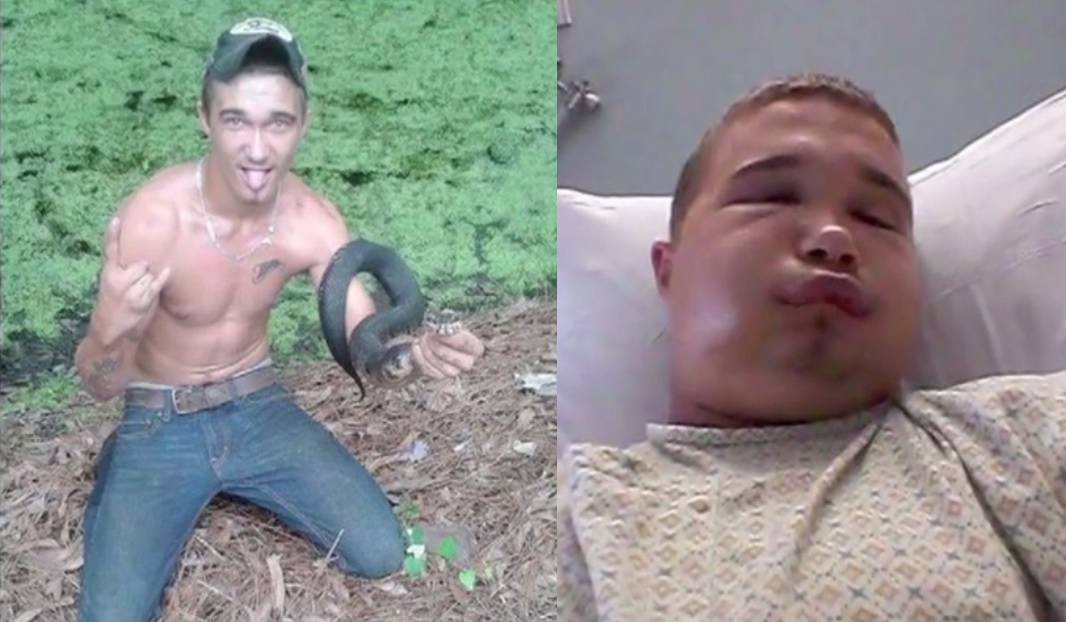outdoorhub-florida-man-tries-to-kiss-pet-cottonmouth-hospitalized-after-bite-2015-04-22_15-14-39.jpg
